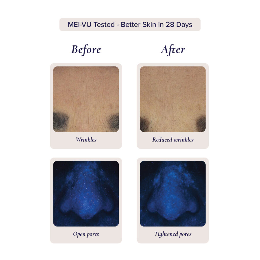 Serum 04