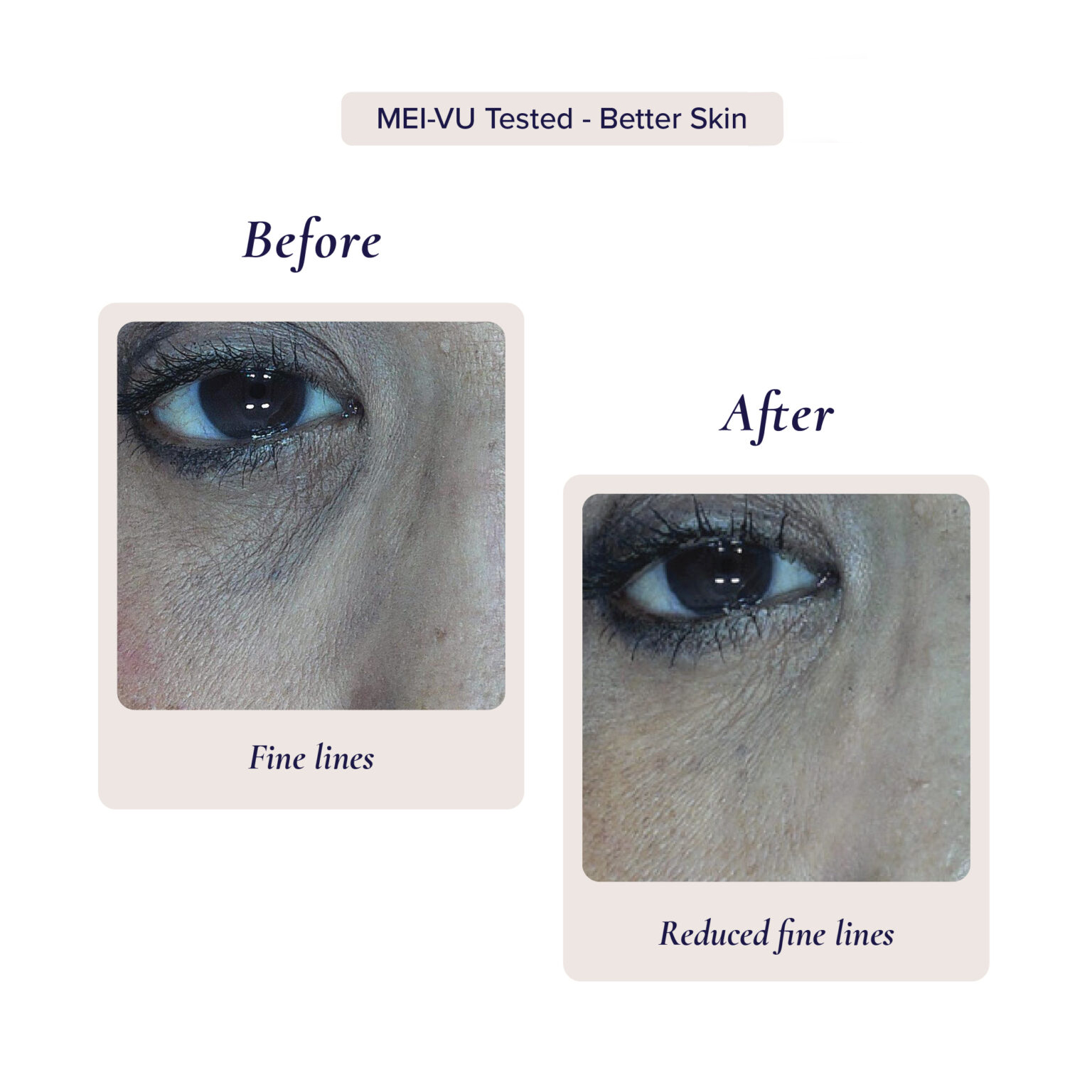 Eye Cream 01 1536x1536